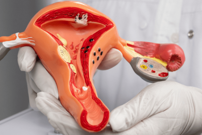 gynaecological conditions