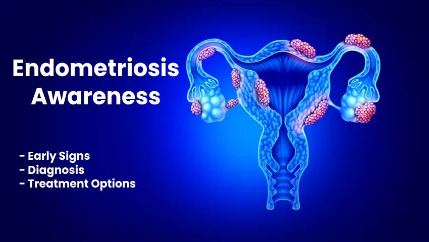 Endometriosis Awareness: Early Signs, Diagnosis, and Treatment Options