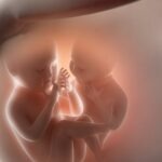 Pregnant woman consulting Dr. Shraddha Galgali, a twin pregnancy specialist near me, at EXCELLA Woman’s Wellness Clinic, Pune