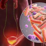 Woman celebrating the festive season while following hygiene tips to prevent UTI during festivals — guided by Dr. Shraddha Galgali, Punawale.