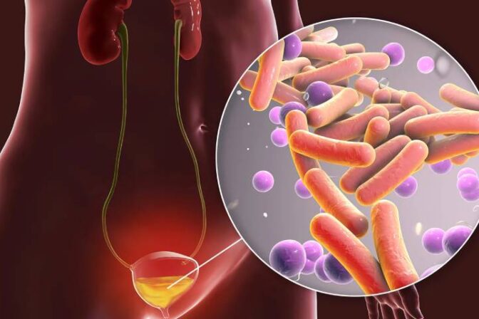 Woman celebrating the festive season while following hygiene tips to prevent UTI during festivals — guided by Dr. Shraddha Galgali, Punawale.