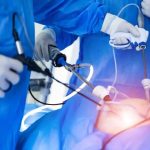 Gynecologist explaining laparoscopic surgery procedure for women